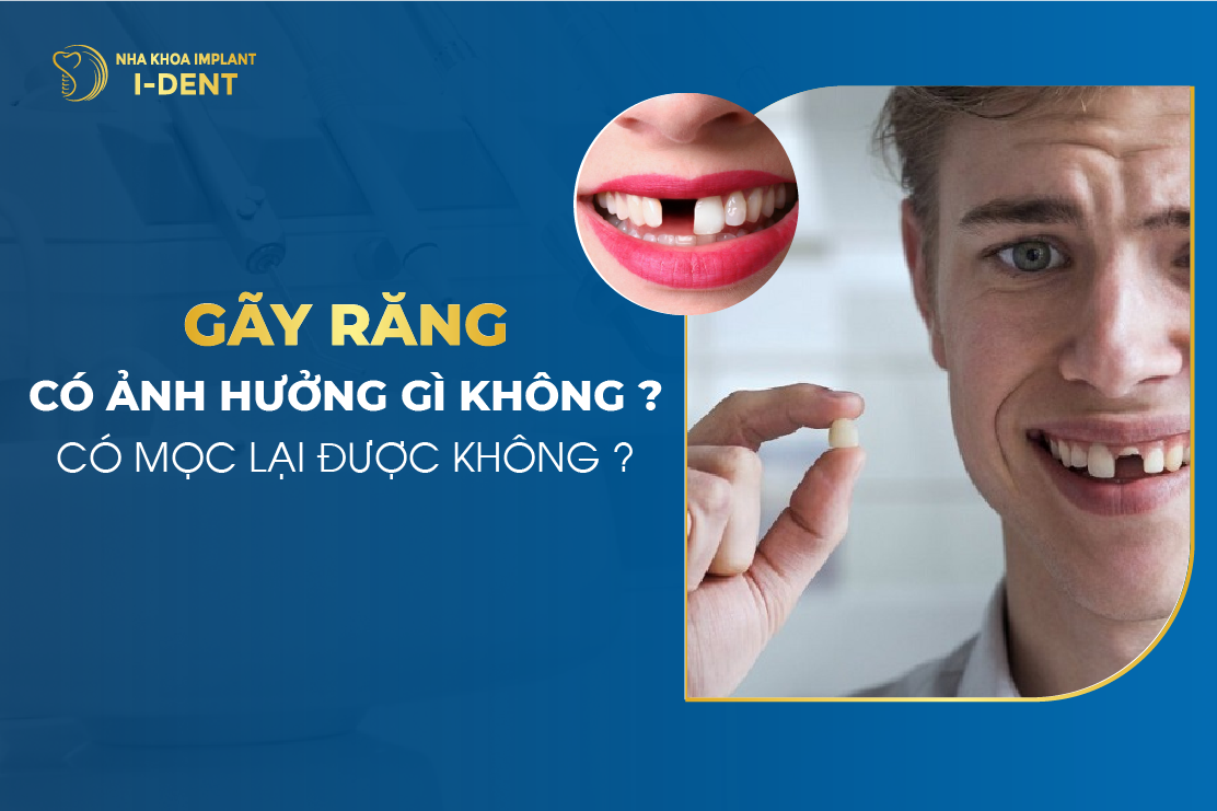 Giải mã giấc mơ thấy gãy răng Điềm báo gì?